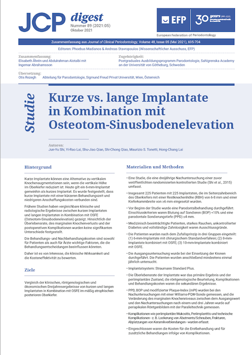 Thumbnail Artikel: Kurze vs. lange Implantate in Kombination mit Osteotom-Sinusbodenelevation